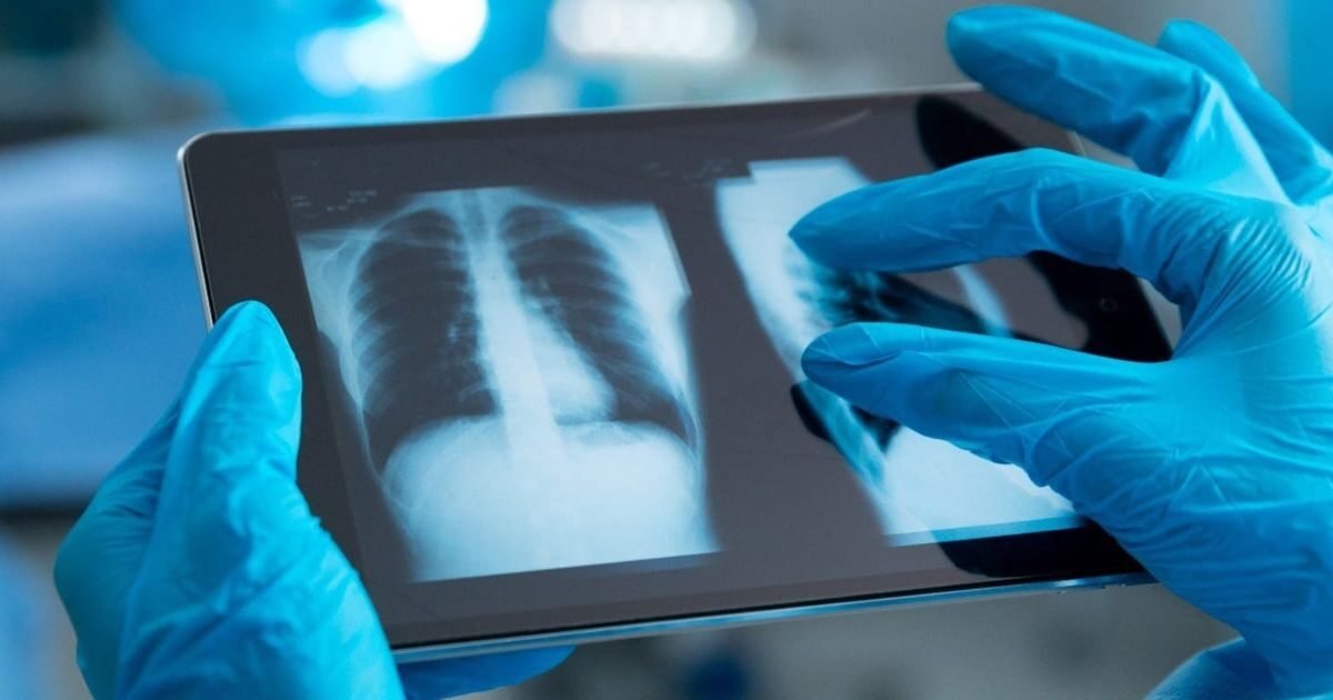 Computer Vision and Image Processing: Applications in Healthcare & Industry