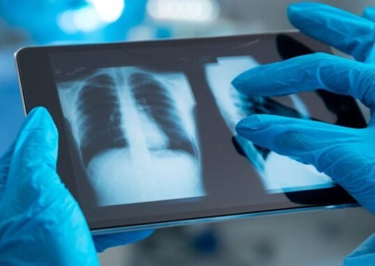 Computer Vision and Image Processing: Applications in Healthcare & Industry