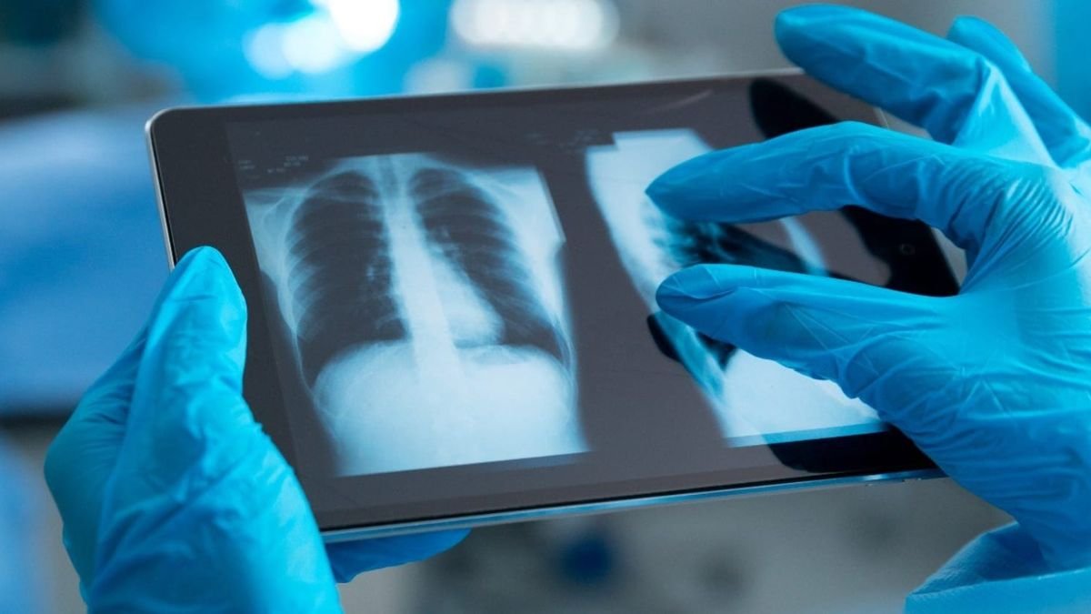 Computer Vision and Image Processing: Applications in Healthcare & Industry